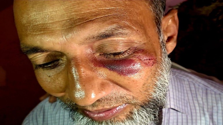সন্দ্বীপে জামায়াতের চীফ এজেন্টের উপর হামলা...