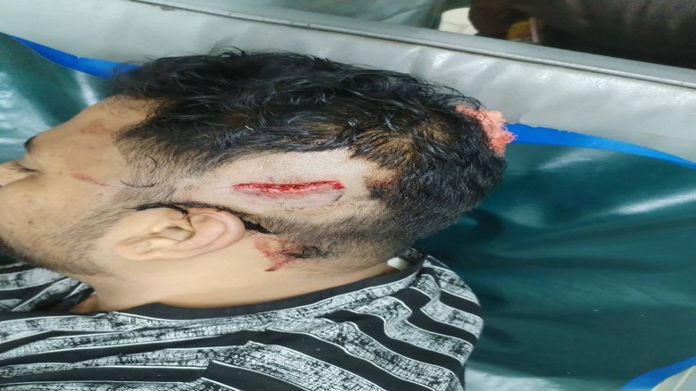 চট্টগ্রামের আনোয়ারায় জামায়াত কর্মীদের উপ বিএনপির হামলা,দফায় দফায় সংঘর্ষ...